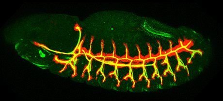 Figure 1: The Drosophila respiratory system...
